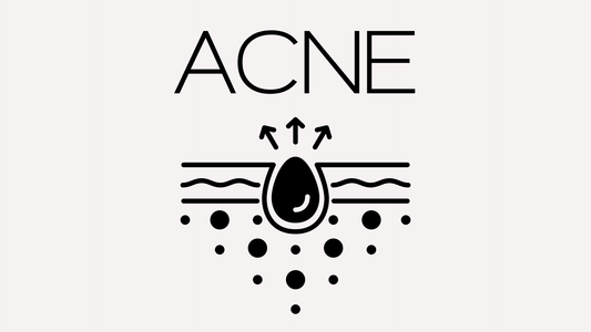 Types of Acne and their Causes | Beautiful by Storm | Advanced Skincare